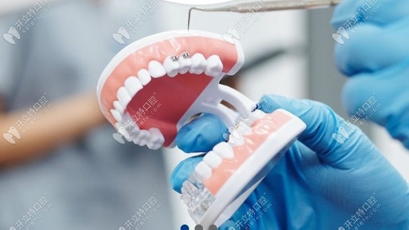 性价比高的牙齿矫正医院，通常具备以下特点：